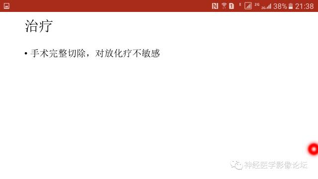【病例】筛窦异位脑膜瘤一例MR