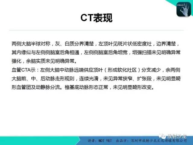 【病例】脑穿通畸形1例CT影像表现
