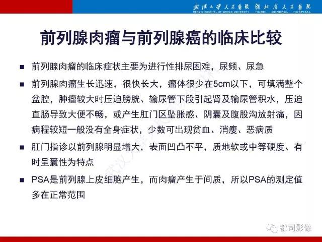 【PPT】前列腺肉瘤的MRI特征与临床病理分析