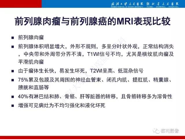 【PPT】前列腺肉瘤的MRI特征与临床病理分析