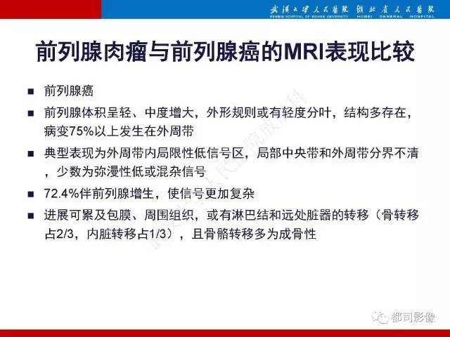 【PPT】前列腺肉瘤的MRI特征与临床病理分析