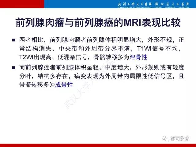 【PPT】前列腺肉瘤的MRI特征与临床病理分析