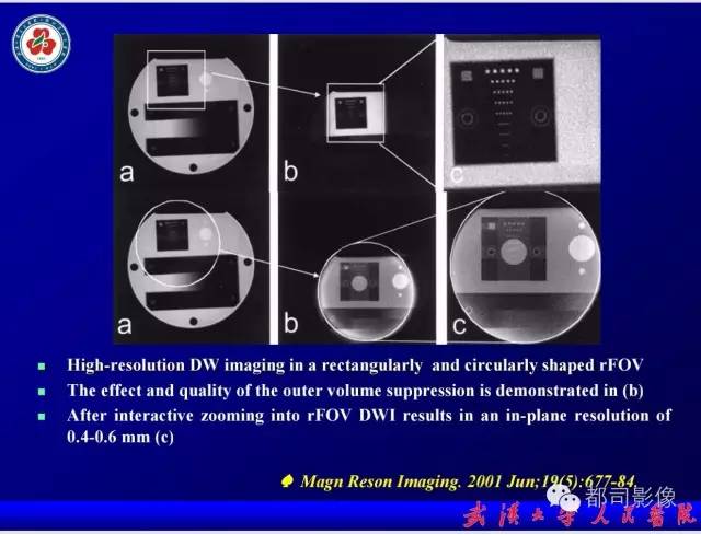 【PPT】小视野扩散加权成像（rFOV-DWI）在前列腺MRI的临床应用
