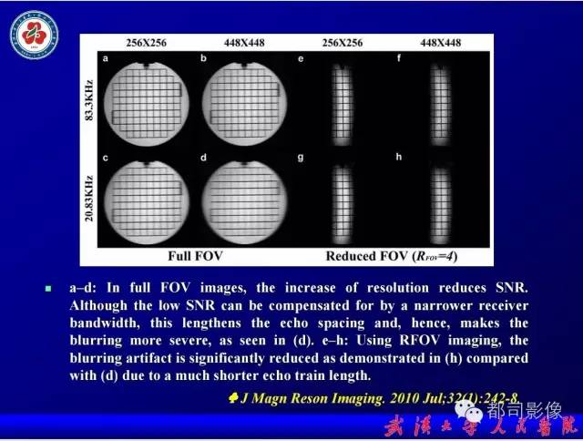 【PPT】小视野扩散加权成像（rFOV-DWI）在前列腺MRI的临床应用