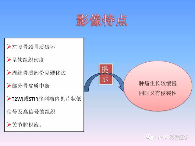 轻松诊断这三个不常见位置的骨巨细胞瘤