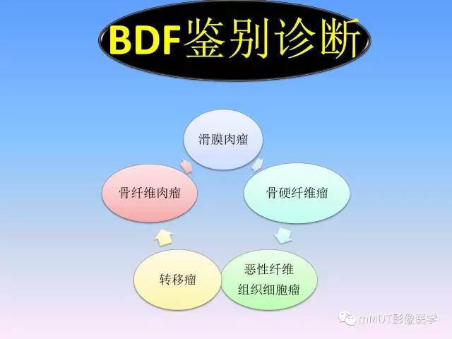 轻松诊断这三个不常见位置的骨巨细胞瘤