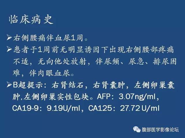 【病例】卵巢甲状腺肿1例CT及MR