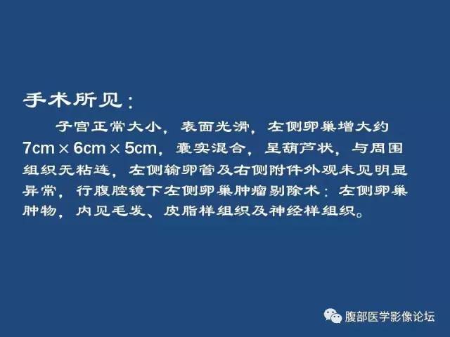 【病例】卵巢甲状腺肿1例CT及MR 【病例】卵巢甲状腺肿1例CT及MR