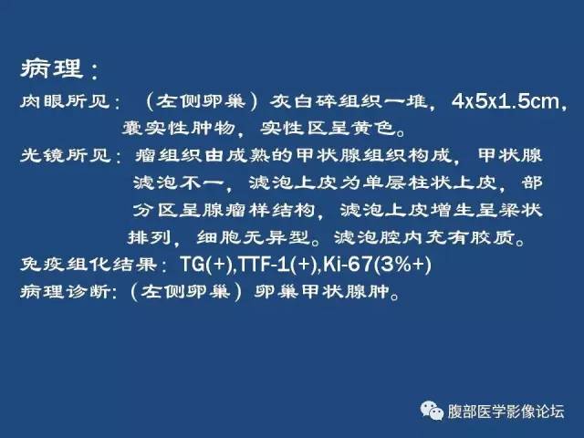 【病例】卵巢甲状腺肿1例CT及MR 【病例】卵巢甲状腺肿1例CT及MR