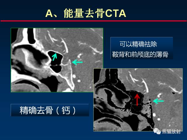【PPT】CT能量成像的理解与应用