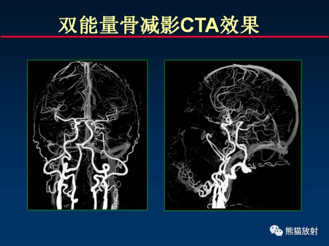 【PPT】CT能量成像的理解与应用
