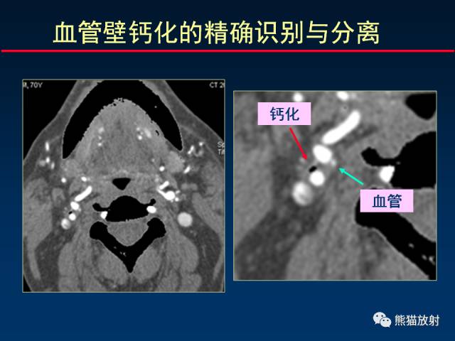 【PPT】CT能量成像的理解与应用