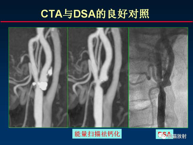 【PPT】CT能量成像的理解与应用