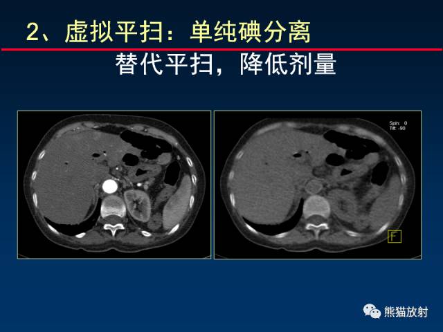 【PPT】CT能量成像的理解与应用