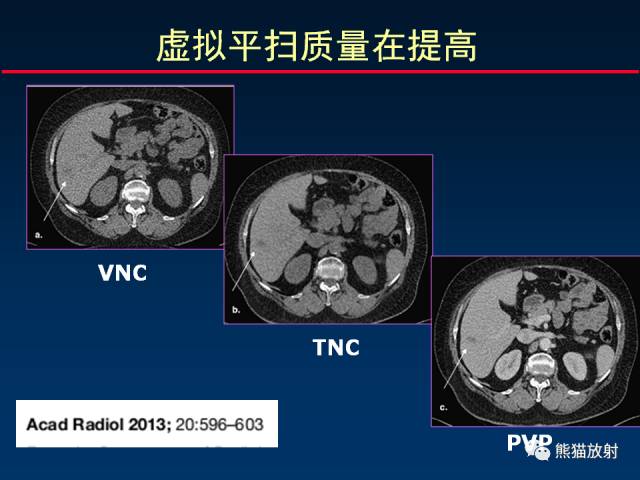 【PPT】CT能量成像的理解与应用
