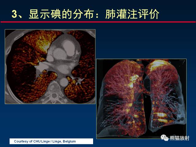 【PPT】CT能量成像的理解与应用
