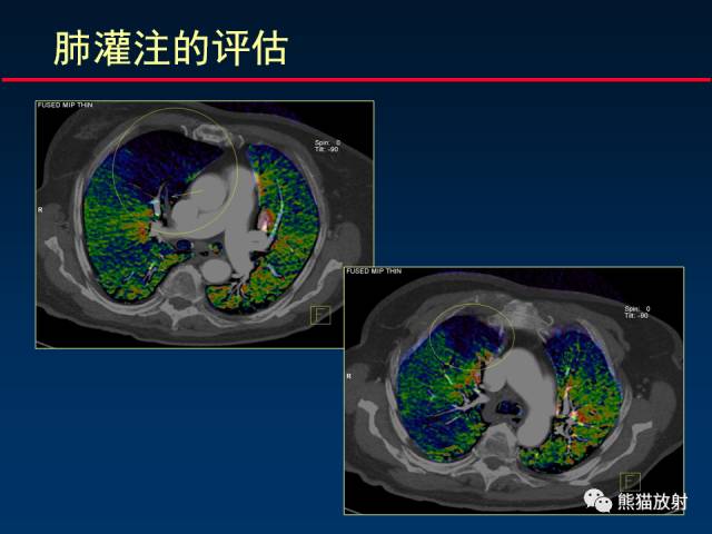 【PPT】CT能量成像的理解与应用