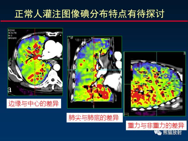 【PPT】CT能量成像的理解与应用