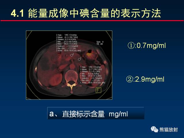 【PPT】CT能量成像的理解与应用