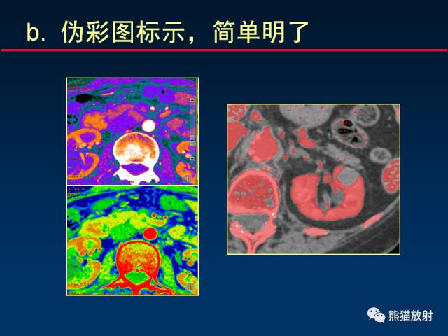 【PPT】CT能量成像的理解与应用