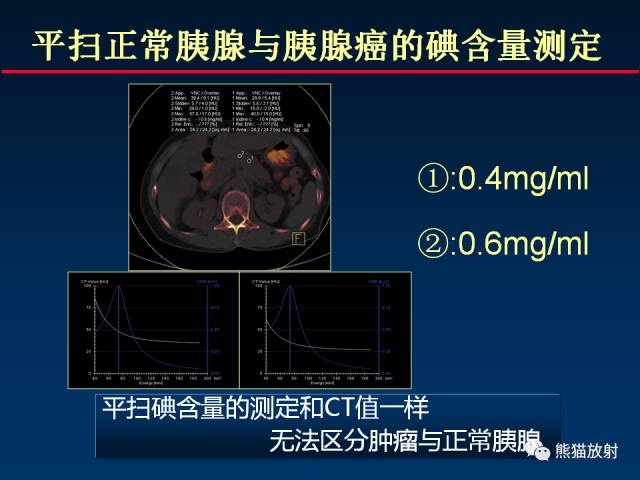 【PPT】CT能量成像的理解与应用