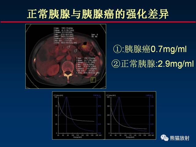 【PPT】CT能量成像的理解与应用