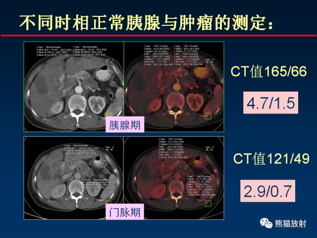 【PPT】CT能量成像的理解与应用