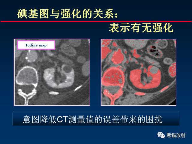 【PPT】CT能量成像的理解与应用