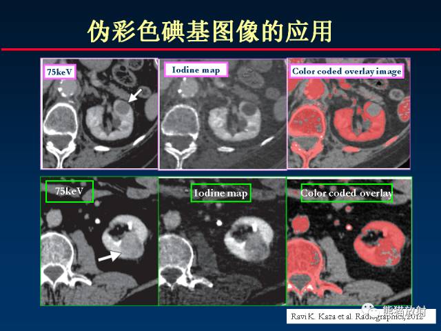 【PPT】CT能量成像的理解与应用