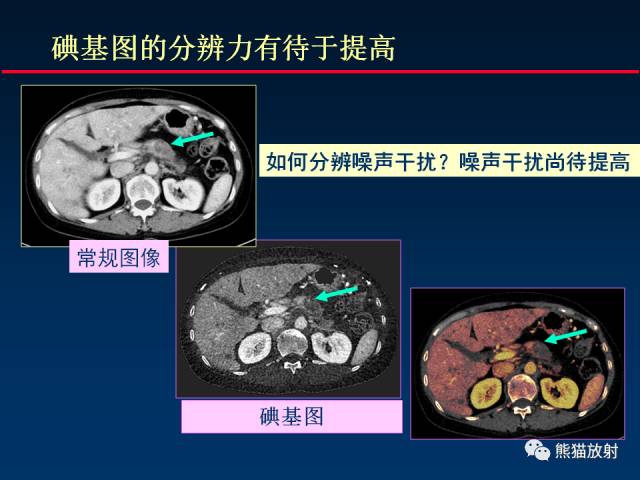 【PPT】CT能量成像的理解与应用