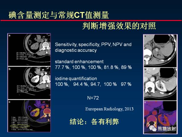 【PPT】CT能量成像的理解与应用