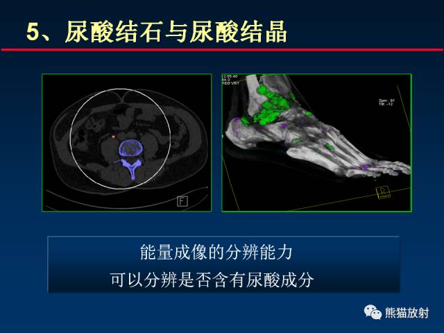 【PPT】CT能量成像的理解与应用