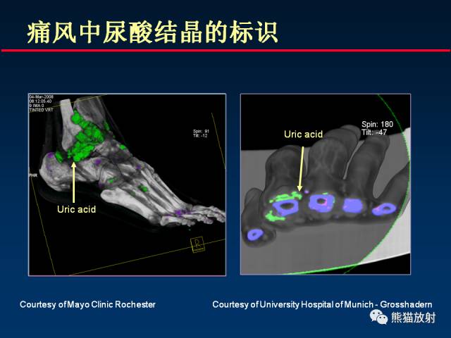 【PPT】CT能量成像的理解与应用