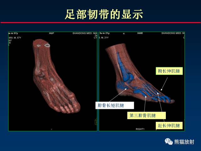 【PPT】CT能量成像的理解与应用