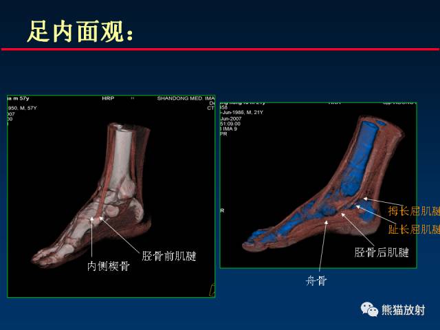 【PPT】CT能量成像的理解与应用