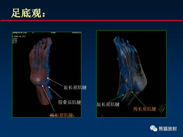 【PPT】CT能量成像的理解与应用