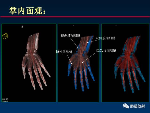 【PPT】CT能量成像的理解与应用