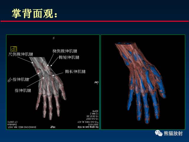 【PPT】CT能量成像的理解与应用