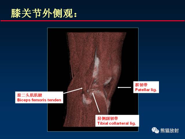 【PPT】CT能量成像的理解与应用