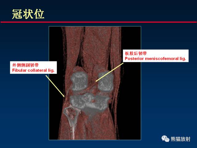 【PPT】CT能量成像的理解与应用
