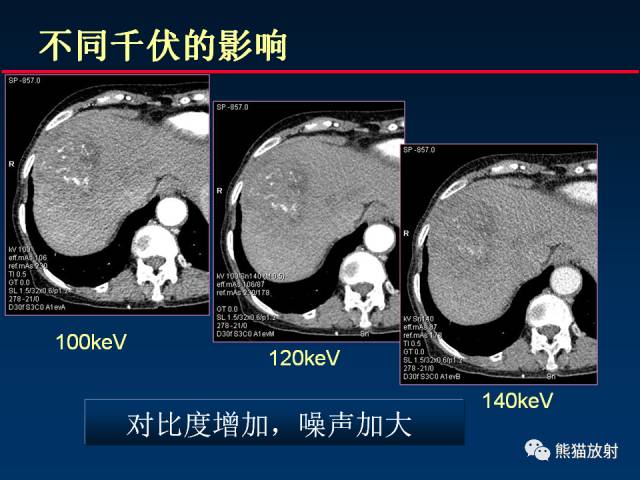 【PPT】CT能量成像的理解与应用