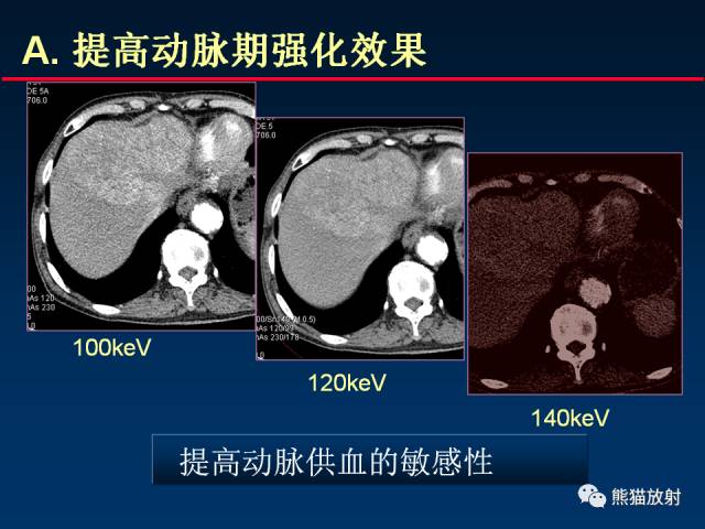 【PPT】CT能量成像的理解与应用