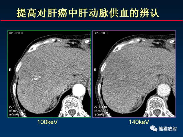 【PPT】CT能量成像的理解与应用