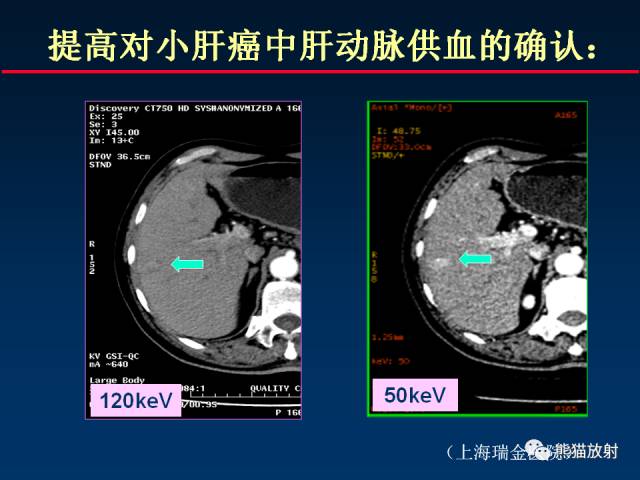 【PPT】CT能量成像的理解与应用