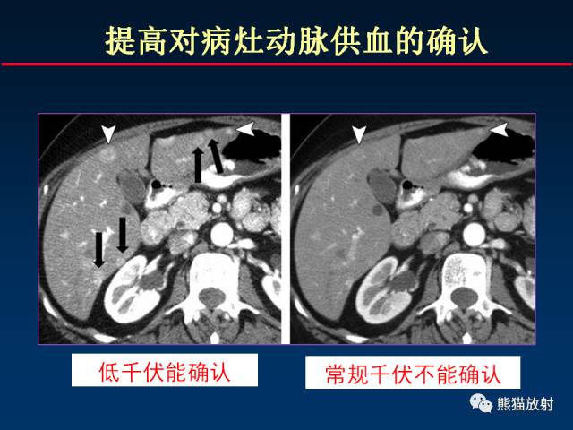 【PPT】CT能量成像的理解与应用