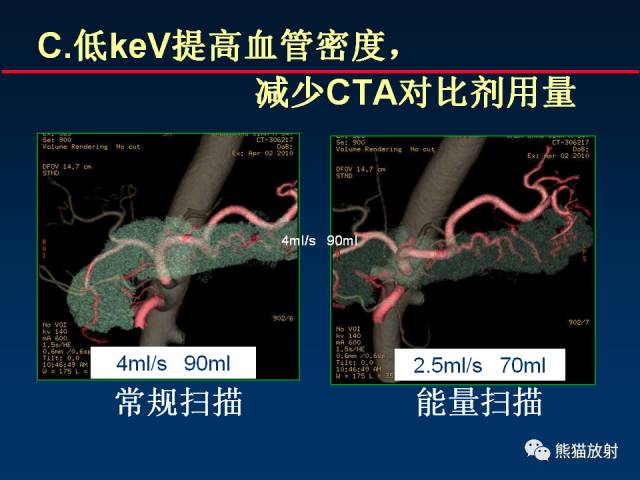 【PPT】CT能量成像的理解与应用