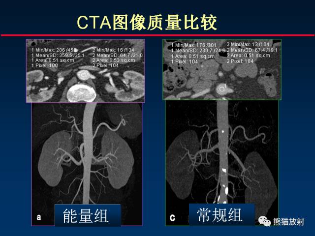 【PPT】CT能量成像的理解与应用