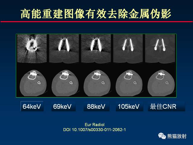 【PPT】CT能量成像的理解与应用