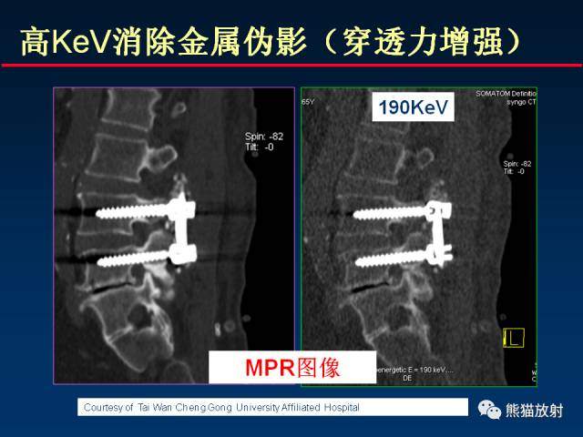【PPT】CT能量成像的理解与应用