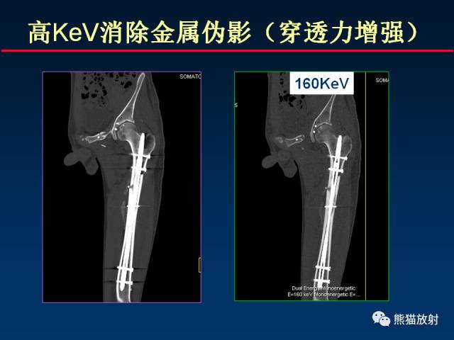 【PPT】CT能量成像的理解与应用
